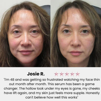Korean Volufiline® Collagen Serum – Plumps & Lifts Skin